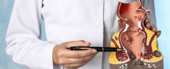 Проктологія